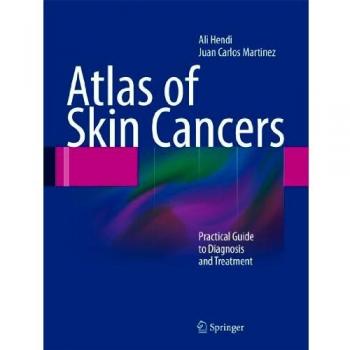 Atlas of Skin Cancers: Practical Guide to Diagnosis and Treatment