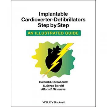 IMPLANTABLE CARDIOVERTER  DEFIBRILLATORS STEP BY STEP