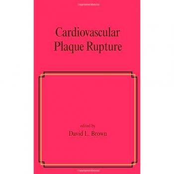 Cardiovascular Plaque Rupture: 45