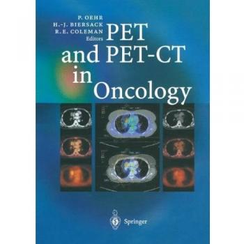 Oncology PET and PET-CT: Fundamentals and Clinical Applications