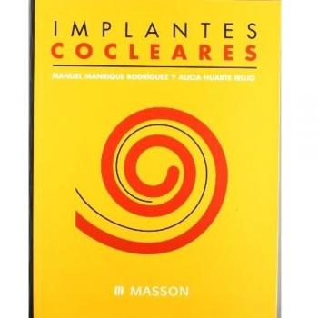 Implantes cocleares