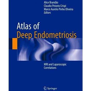 Atlas of Deep Endometriosis: MRI and Laparoscopic Correlations