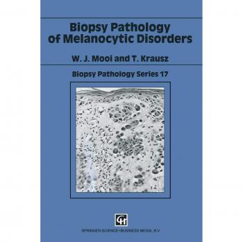 Biopsy Pathology of Melanocytic Disorders: 2