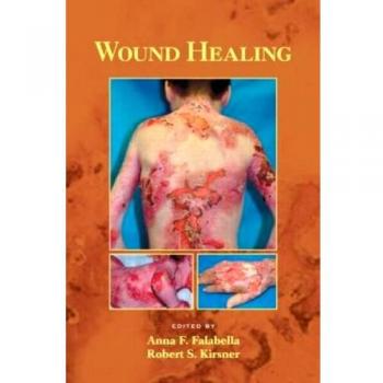 Marcel Dekker Advanced Wound Healing Solutions