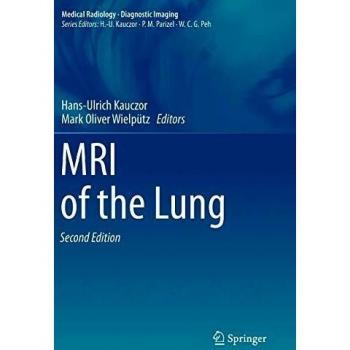 MRI of the Lung
