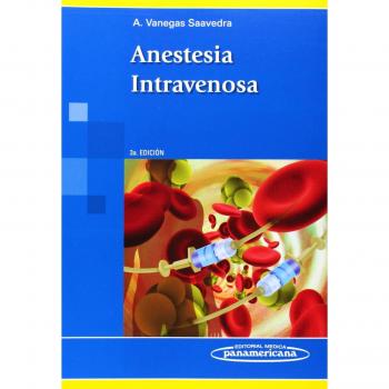 Anestesia intravenosa
