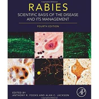 Rabies: Scientific Basis of the Disease and Its Management