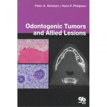 Odontogenic Tumours and Allied Lesions