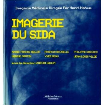 Imagerie du SIDA