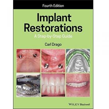 Iowa State University Press Comprehensive Guide to Implant Restorations