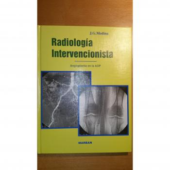Radiología intervencionista