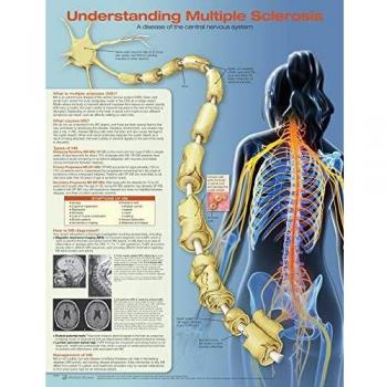 Anatomical Chart 9781496394989 Understanding Multiple Sclerosis Laminado
