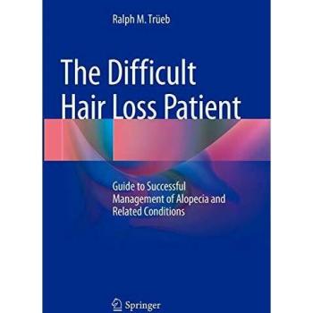 The Difficult Hair Loss Patient: Guide to Successful Management of Alopecia and Related Conditions