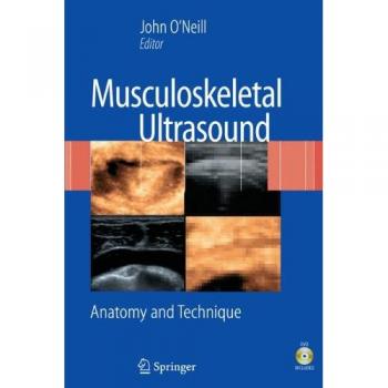 Musculoskeletal Ultrasound: Anatomy and Technique [With DVD] by John M. D. O'Neill - Comprehensive Guide for Clinicians