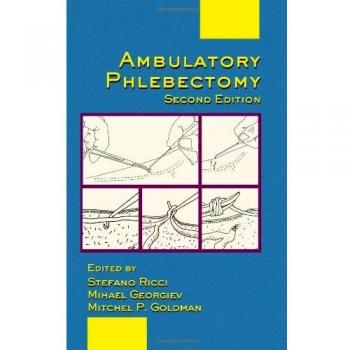 Ambulatory Phlebectomy