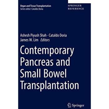 Contemporary Pancreas and Small Bowel Transplantation