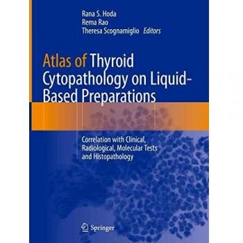 Atlas of Thyroid Cytopathology on Liquid-Based Preparations: Correlation with Clinical, Radiological, Molecular Tests and Histopathology