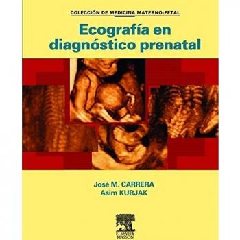 Ecografía en diagnóstico prenatal