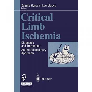 Critical Limb Ischemia: Diagnosis and Treatment: An Interdisciplinary Approach