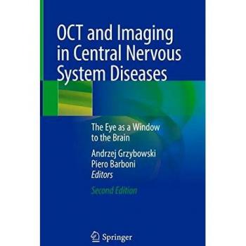 OCT and Imaging in Central Nervous System Diseases: The Eye as a Window to the Brain