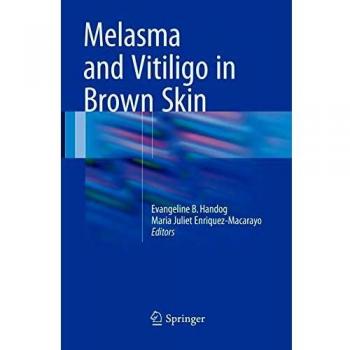 Melasma and Vitiligo in Brown Skin