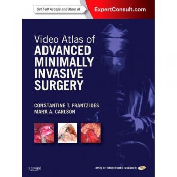 Video Atlas of Advanced Minimally Invasive Surgery: Expert Consult - Online and Print, 1e