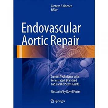 Endovascular Aortic Repair: Current Techniques with Fenestrated, Branched and Parallel Stent-Grafts