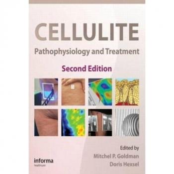 Cellulite: Pathophysiology and Treatment: 1