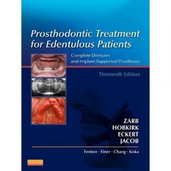 Prosthodontic Treatment for Edentulous Patients: Complete Dentures and Implant-Supported Prostheses, 13e