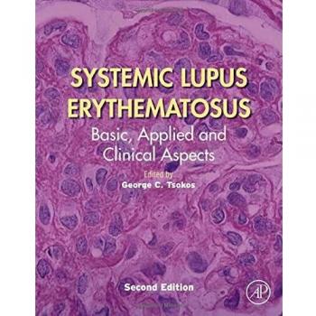 Systemic Lupus Erythematosus: Basic, Applied and Clinical Aspects