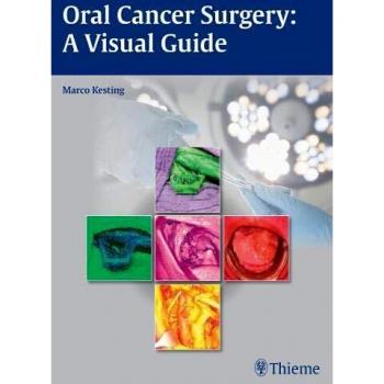 Oral Cancer Surgery: A Visual Guide