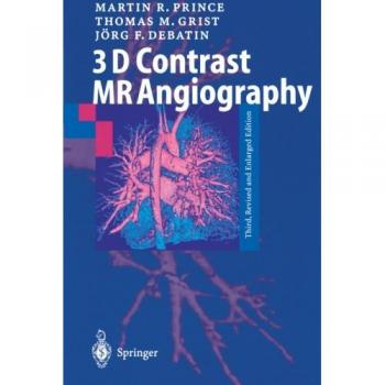 3D Contrast MR Angiography