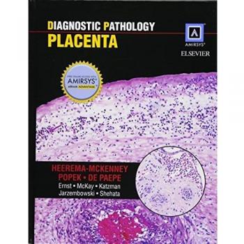 Diagnostic Pathology: Placenta, 1e