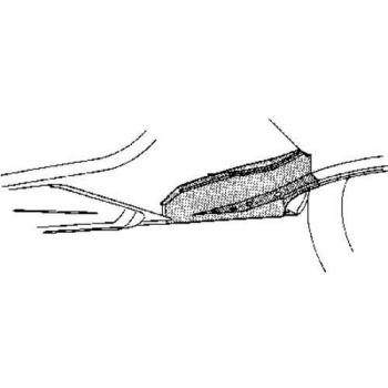 Larguero Chasis Van Wezel 5810311