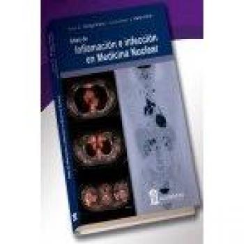 Atlas de Inflamación e infección en Medicina Nuclear