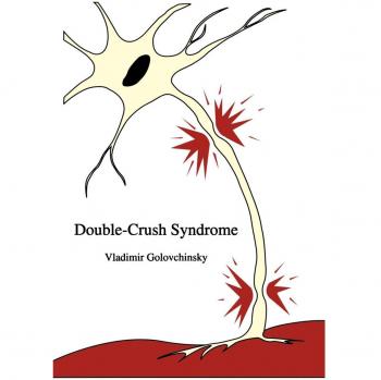 Double-Crush Syndrome: A Comprehensive Guide on Diagnosis and Treatment