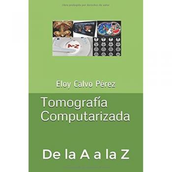 Tomografía Computarizada: De la A a la Z