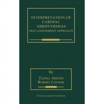 Cardiac Arrhythmias Interpretation Guide