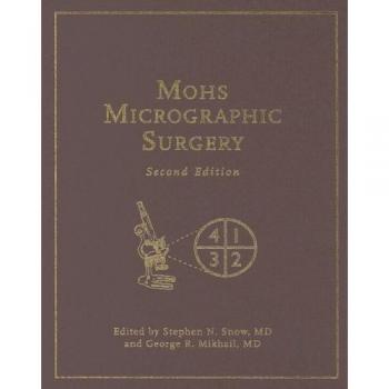 Mohs Micrographic Surgery