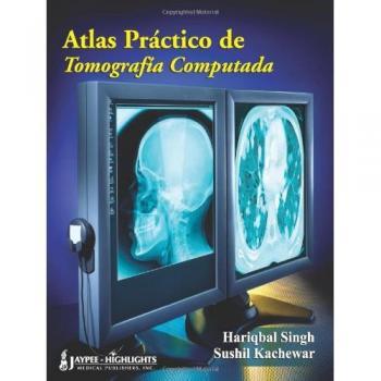 Atlas Práctico de Tomografia Computada