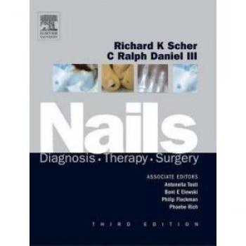 Nails: Diagnosis, Therapy, Surgery, 3e