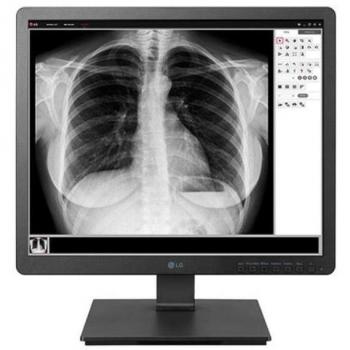LG 19HK312C Monitor para PC 48,3 cm (19) SXGA LED Plano 1280 x 1024 Pixeles 14 ms Negro