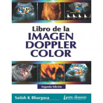 Libro de la Imagen Doppler Color