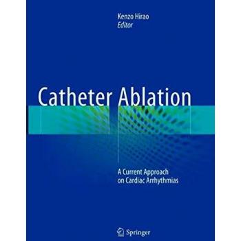 Catheter Ablation: A Current Approach on Cardiac Arrhythmias