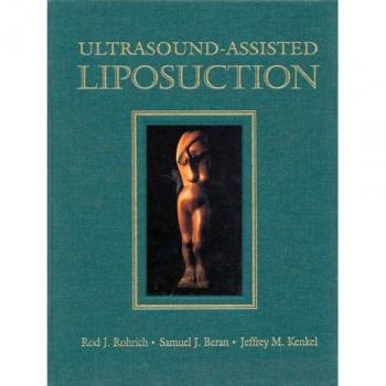 Ultrasound-Assisted Liposuction