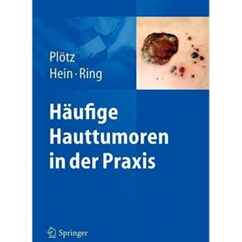Häufige Hauttumoren in der Praxis