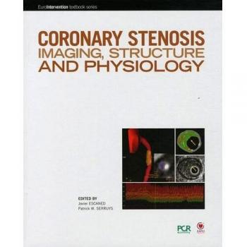 Coronary stenosis imaging, structure and physiology