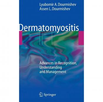 Dermatomyositis: Advances in Recognition, Understanding and Management