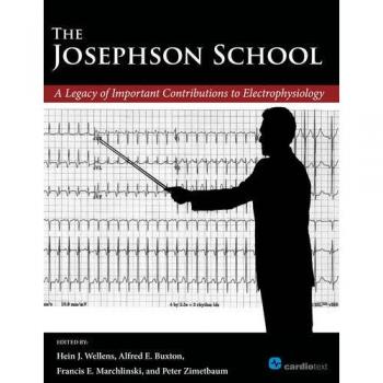 Josephson Electrophysiology Legacy Guide