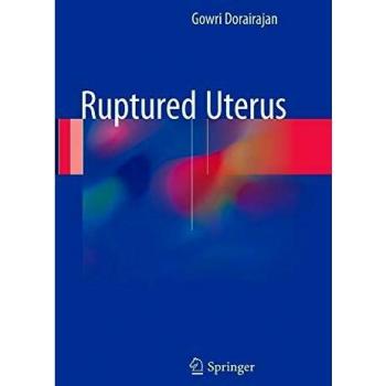 Ruptured Uterus